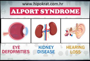 Alportov sindrom (hereditarni nefritis)