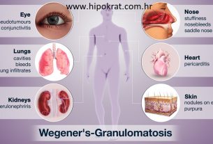 Wegenerova granulomatoza