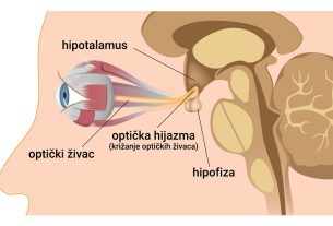 Tumor hipofize