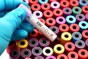 Epstein-Barr Virus (EBV) - uzrok, simptomi i liječenje
