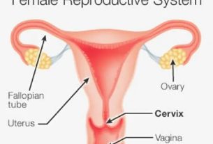 Cervicitis (upala vrata maternice)